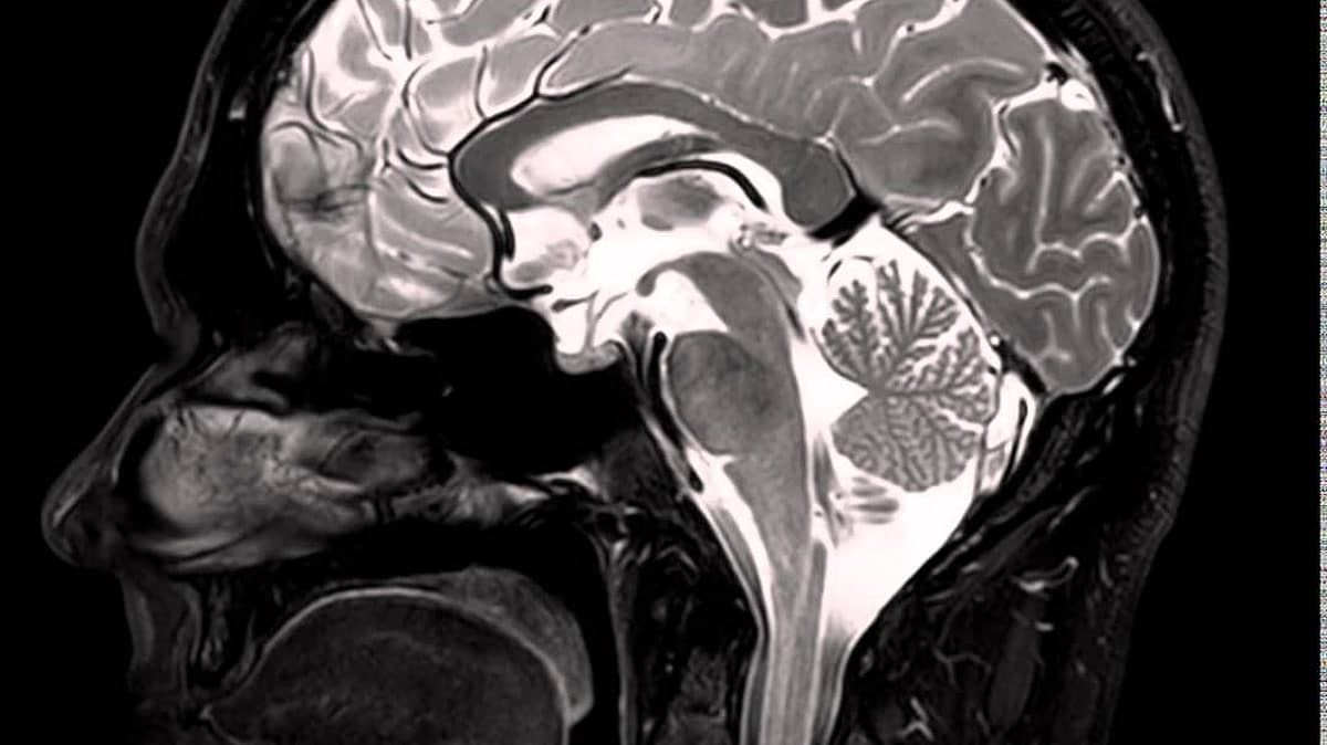 Dopamine detox: what it is and how to do one